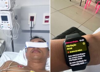 Homem descobre princípio de parada cardíaca após alerta de relógio inteligente: ‘Renasci’