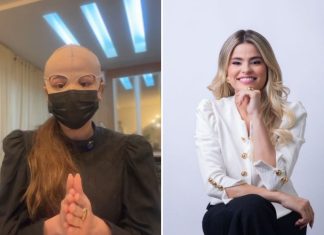 Médica pagou R$ 8 mil por peeling no rosto e diz que gastos com tratamento após queimaduras chegam a R$ 10 mil