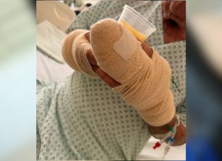 Família diz que idoso atacado por pitbull está com medo de voltar para casa e moradores cobram ação da prefeitura