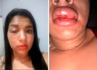 ‘Estou tendo que me esconder’, desabafa jovem agredida por vereador no Tocantins