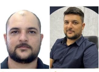 PC diz que foragido por fraude de R$ 55 milhões no agro fez procedimento estético e divulga cartaz de procurado